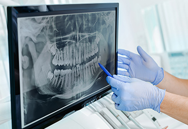 歯科用モニター